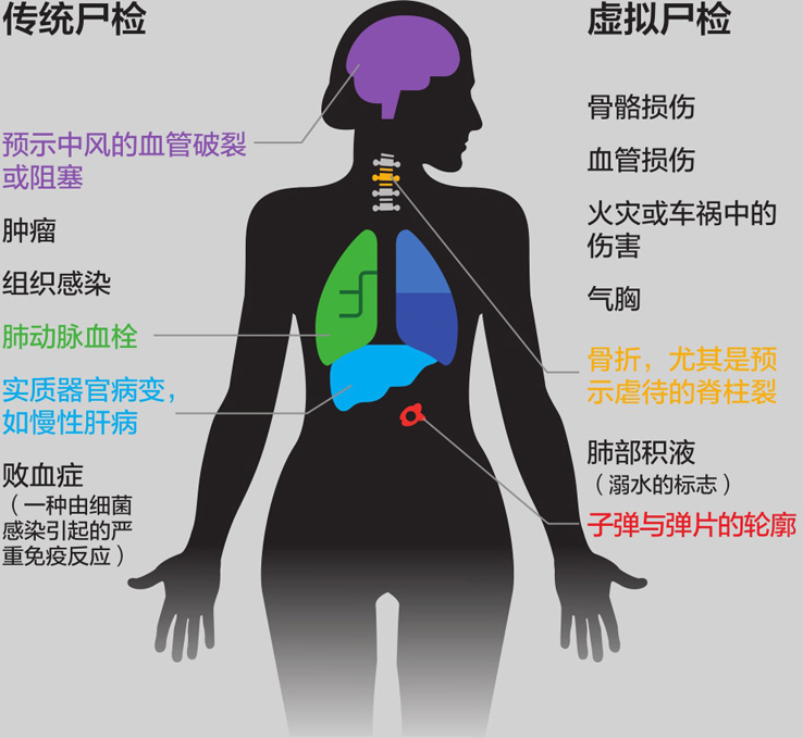 尸检迎来虚拟时代